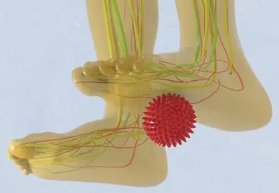 1: Stimulating the Peroneal Nerve